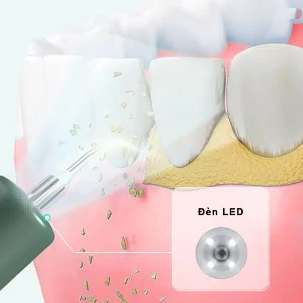 Xiaomi Dr.Bei T1 Ultrasonic Teeth Cleaner 4